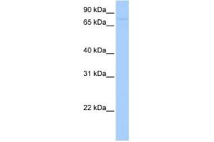 SAMD4A antibody used at 1 ug/ml to detect target protein. (SAMD4A 抗体  (Middle Region))