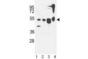 ATG13 antibody western blot analysis in 1) MDA-MB435,2) CEM, 3) T47D cell line and 4) mouse cerebellum tissue lysate. (ATG13 抗体  (AA 1-30))