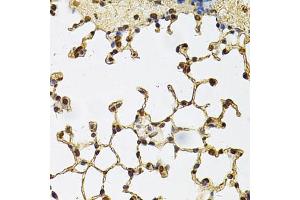 Immunohistochemistry of paraffin-embedded mouse lung using IFI16 Antibody. (IFI16 抗体)