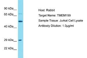 Host: Rabbit Target Name: TMEM199 Sample Tissue: Human Jurkat Whole Cell Antibody Dilution: 1ug/ml (TMEM199 抗体  (N-Term))