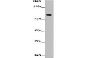 Western blot All lanes: EHD1 antibody at 12 μg/mL + MDA-MB-231 whole cell lysate Secondary Goat polyclonal to rabbit IgG at 1/10000 dilution Predicted band size: 61 kDa Observed band size: 61 kDa (EHD1 抗体  (AA 401-498))