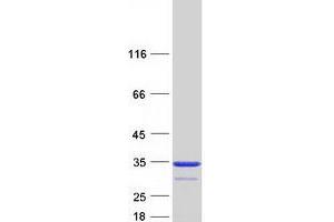 Western Blotting (WB) image for Carbonic Anhydrase III (CA3) protein (Myc-DYKDDDDK Tag) (ABIN2713128)