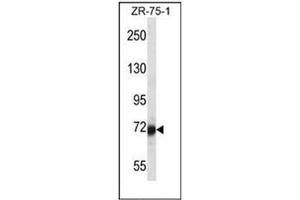 Western blot analysis of SP100 Antibody (N-term) in ZR-75-1 cell line lysates (35ug/lane).