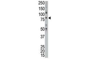 Image no. 1 for anti-TPX2, Microtubule-Associated, Homolog (Xenopus Laevis) (TPX2) (C-Term) antibody (ABIN357426)