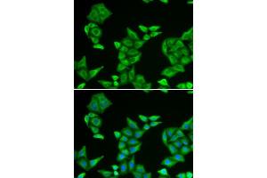 Immunofluorescence analysis of U2OS cells using COX5A antibody. (COX5A 抗体  (AA 1-150))