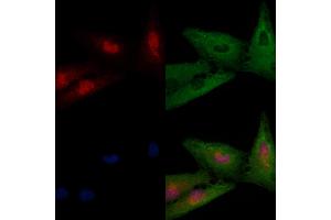 ABIN6265105 and ABIN6266826 staining  cells by IF/ICC.
