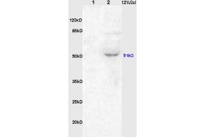 L1 rat kidney lysates, L2 rat brain lysates probed (ABIN738396) Anti-ChRM1/Acetylcholine receptor(M1) Polyclonal, Unconjugated at 1:200 in 4 °C. (CHRM1 抗体  (AA 321-420))