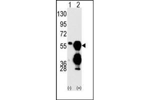 Image no. 1 for anti-Protein Phosphatase 1F (PP2C Domain Containing) (PPM1F) (C-Term) antibody (ABIN360801) (PPM1F 抗体  (C-Term))