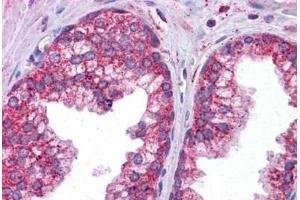 Immunohistochemistry (Formalin-fixed Paraffin-embedded Sections) (IHC (fp)) image for anti-Signal Transducer and Activator of Transcription 6, Interleukin-4 Induced (STAT6) (AA 614-663) antibody (ABIN6745701)