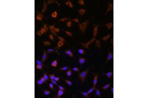 Immunofluorescence (IF) image for anti-Glucosidase, Alpha, Neutral AB (GANAB) (AA 1-260) antibody (ABIN6140952)