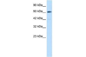 Western Blot showing ZNF499 antibody used at a concentration of 1-2 ug/ml to detect its target protein. (ZBTB45 抗体  (Middle Region))