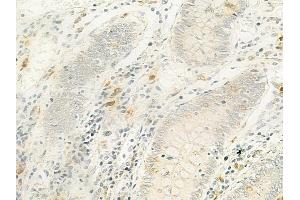 ABIN6265717 and ABIN6279876 at 1/100 staining human normal placenta tissue by IHC-P.