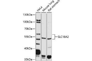 Western blot analysis of extracts of various cell lines, using SLC18 antibody (799) at 1:2000 dilution. (SLC18A2 抗体)