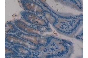 Detection of TFF3 in Rat Intestine Tissue using Polyclonal Antibody to Trefoil Factor 3 (TFF3) (TFF3 抗体  (AA 23-81))