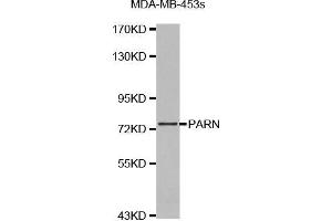 Western blot analysis of extracts of MDA-MB-453s cell lines, using PARN antibody. (PARN 抗体  (AA 1-280))