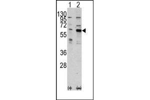 Image no. 1 for anti-PAK3 (PAK3) (Middle Region) antibody (ABIN360320) (PAK3 抗体  (Middle Region))
