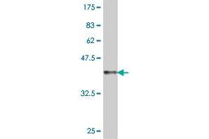 Western Blotting (WB) image for anti-ClpP Caseinolytic Peptidase, ATP-Dependent, Proteolytic Subunit Homolog (E. Coli) (CLPP) (AA 178-277) antibody (ABIN563559)