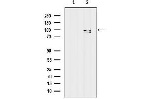 anti-Topoisomerase (DNA) III beta (TOP3B) (C-Term) antibody