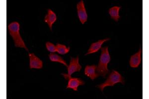 ABIN6259882 and ABIN6273091 staining HepG2 by IF/ICC. (ALDH7A1 抗体  (C-Term))