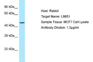 Host: RabbitTarget Name: LIMS1Antibody Dilution: 1. (LIMS1 抗体  (C-Term))
