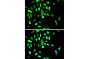 Immunofluorescence analysis of A549 cells using CDK1 antibody. (CDK1 抗体)