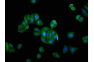 Immunofluorescence staining of HepG2 cells with ABIN7153297 at 1:166, counter-stained with DAPI. (GRK5 抗体  (AA 406-590))