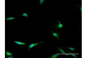 Immunofluorescence of purified MaxPab antibody to ENOPH1 on HeLa cell. (MASA 抗体  (AA 1-261))