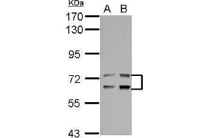 WB Image Sample (30 ug of whole cell lysate) A: Jurkat B: Raji 7. (LTA4H 抗体)