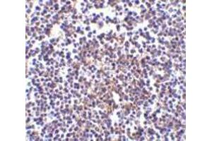 Immunohistochemistry of Aven in human spleen tissue with Aven antibody at 5 μg/ml. (AVEN 抗体  (C-Term))