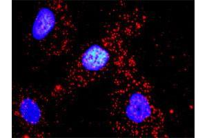 Proximity Ligation Analysis of protein-protein interactions between VASP and ACTG1. (Actin, gamma 1 抗体  (AA 1-375))