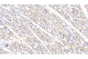 Immunohistochemistry (IHC) image for anti-ATP-Binding Cassette, Sub-Family F (GCN20), Member 1 (ABCF1) (AA 625-845) antibody (ABIN7444997)