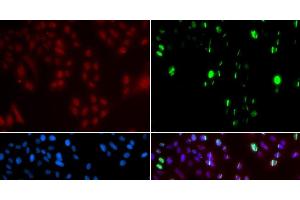 Immunofluorescence analysis of GFP-RNF168 transgenic U2OS cells using FANCD2 Polyclonal Antibody (FANCD2 抗体)