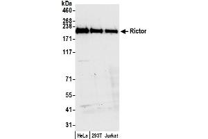 Western Blotting (WB) image for anti-RPTOR Independent Companion of mTOR, Complex 2 (RICTOR) (C-Term) antibody (ABIN7454633) (RICTOR 抗体  (C-Term))