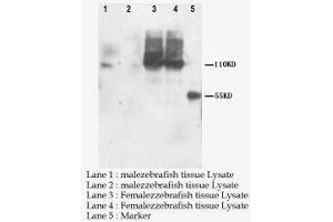 Image no. 1 for anti-Patatin-Like phospholipase Domain Containing 6 (PNPLA6) (C-Term) antibody (ABIN1493338) (PNPLA6 抗体  (C-Term))