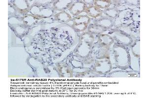 Formalin-fixed and paraffin embedded rat kidney labeled with Anti RAB20 Polyclonal Antibody, Unconjugated  at 1:200 followed by conjugation to the secondary antibody and DAB staining (RAB20 抗体  (AA 131-234))