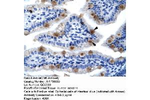 Human Lung (MCM6 抗体  (C-Term))