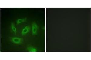 Immunofluorescence (IF) image for anti-Transforming Growth Factor, beta Receptor 1 (TGFBR1) (AA 131-180) antibody (ABIN2888904) (TGFBR1 抗体  (AA 131-180))