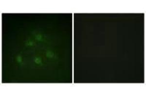 Immunofluorescence analysis of HeLa cells, using Smad1 (Ab-187) antibody. (SMAD1 抗体  (Ser187))