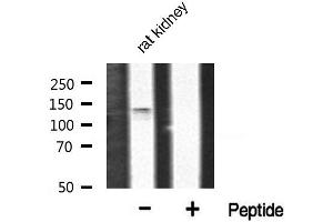 Western blot analysis of FGFR1 phosphorylation expression in rat kidney tissue lysates,The lane on the right is treated with the antigen-specific peptide. (FGFR1 抗体  (pTyr766))