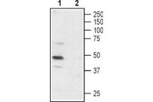 Western blot analysis of rat DRG: - 1. (P2X3 Receptor (AA 65-79), (Extracellular) 抗体)