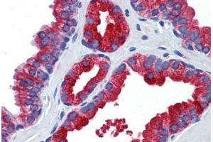 Human Prostate: Formalin-Fixed, Paraffin-Embedded (FFPE) (Klotho 抗体  (AA 720-769))