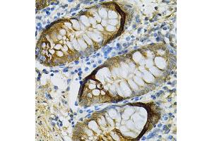 Immunohistochemistry of paraffin-embedded human colon using SELENBP1 Antibody (ABIN5970564) at dilution of 1/100 (40x lens). (SELENBP1 抗体)