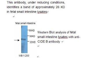 Image no. 1 for anti-Cell Death-Inducing DFFA-Like Effector B (CIDEB) antibody (ABIN790841) (CIDEB 抗体)