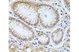 Immunohistochemistry of paraffin-embedded Human stomach using CPM Polyclonal Antibody at dilution of 1:100 (40x lens). (CPM 抗体)