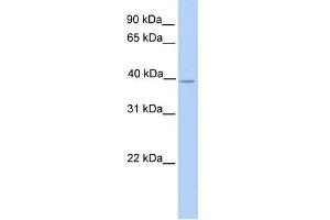 WB Suggested Anti-NEK6 Antibody Titration:  0. (NEK6 抗体  (N-Term))