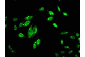 Immunofluorescent analysis of Hela cells using ABIN7148353 at dilution of 1:100 and Alexa Fluor 488-congugated AffiniPure Goat Anti-Rabbit IgG(H+L) (C1R 抗体  (AA 65-192))