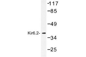 Image no. 1 for anti-Potassium Inwardly-Rectifying Channel, Subfamily J, Member 11 (KCNJ11) antibody (ABIN317660) (KCNJ11 抗体)