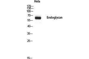 Western Blot (WB) analysis of HeLa using Endoglycan antibody. (PODXL2 抗体)