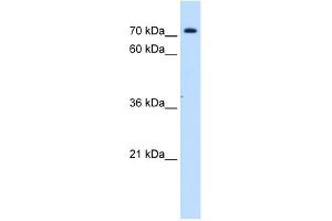 SLC5A11 antibody used at 1 ug/ml to detect target protein. (Solute Carrier Family 5 (Sodium/inositol Cotransporter), Member 11 (SLC5A11) 抗体)