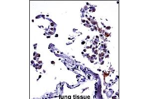 IL13 Antibody (C-term) ((ABIN657659 and ABIN2846653))immunohistochemistry analysis in formalin fixed and paraffin embedded human lung tissue followed by peroxidase conjugation of the secondary antibody and DAB staining.